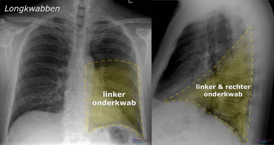 Hoeveel Longkwabben Heeft Een Mens